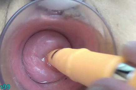 Explore The Luscious Japanese Milf's Cervix With German Real Penis And Chopsticks